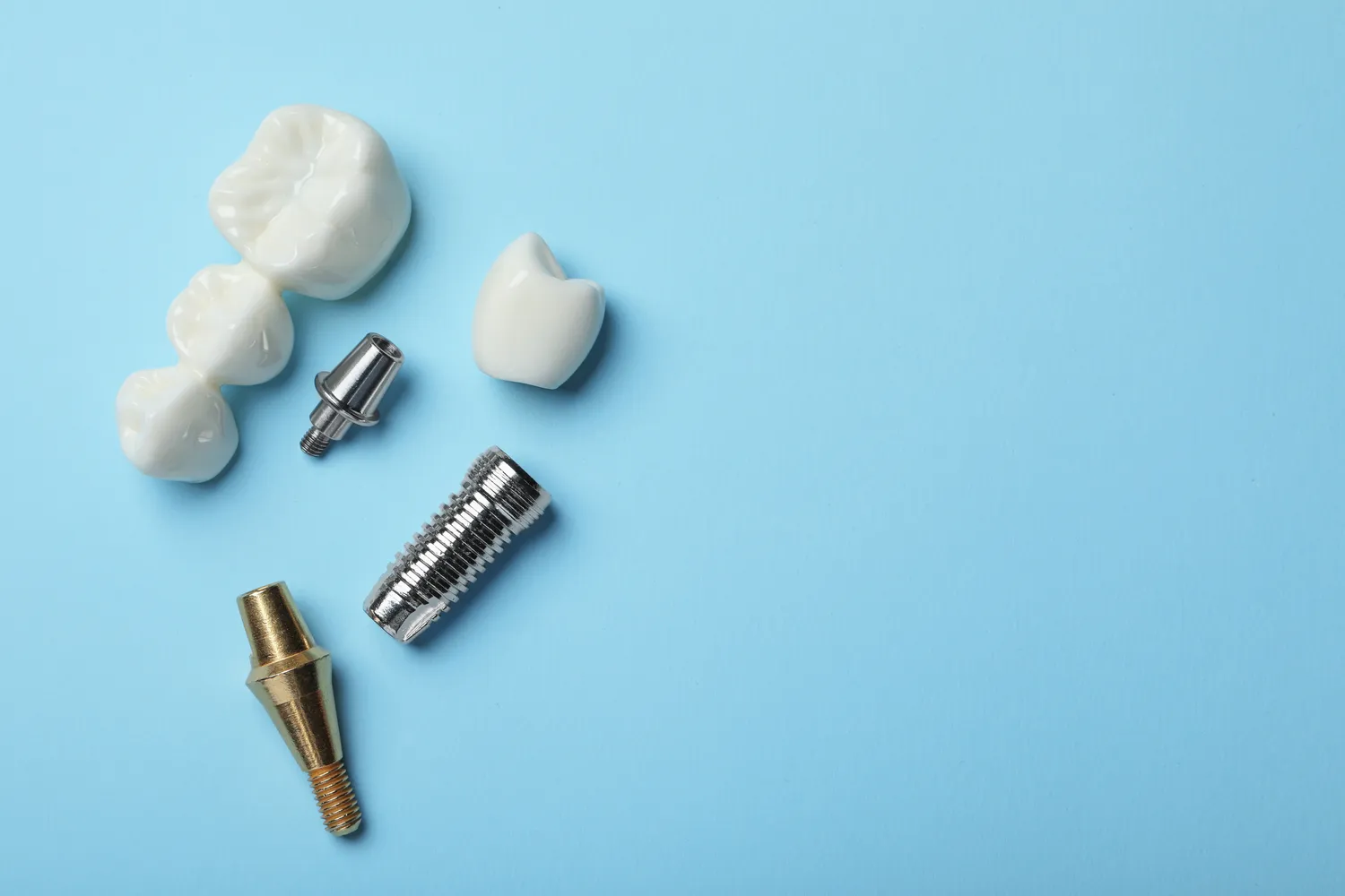 Implanty dentystyczne Szczecin