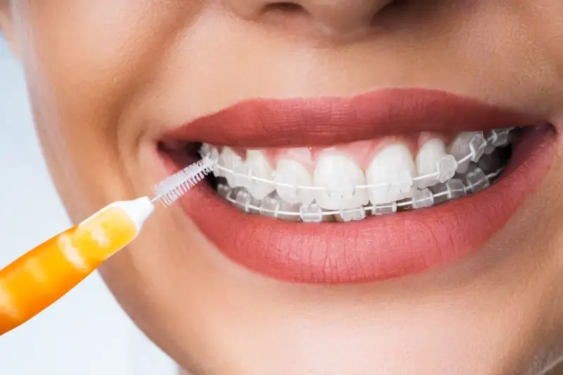 Licówki ranking Szczecin