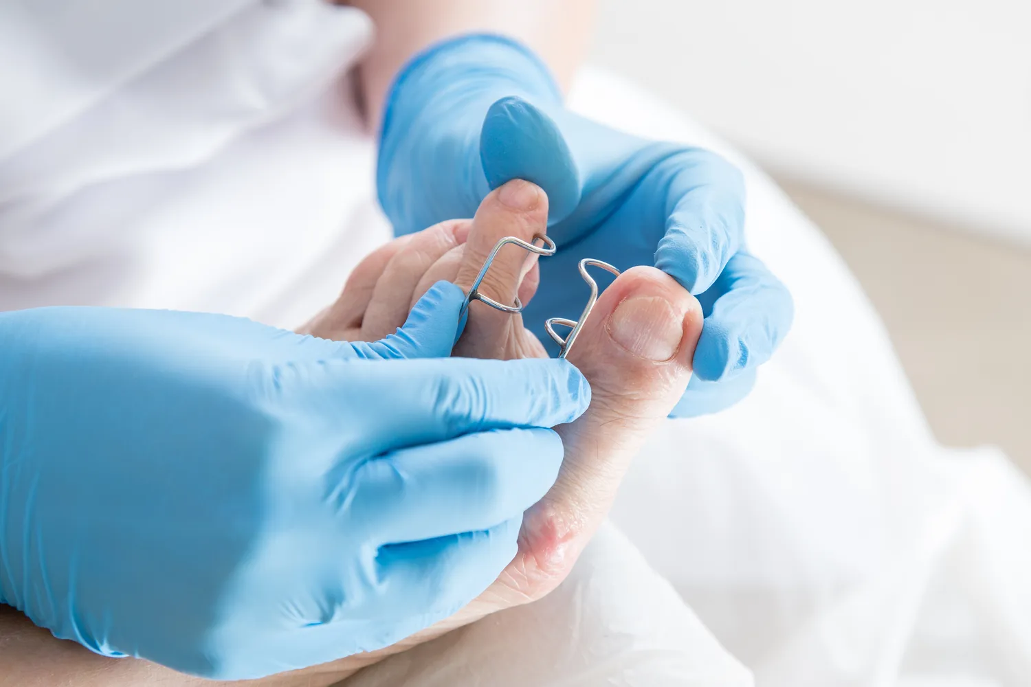  Dlaczego warto rozważyć wizytę w gabinecie podologa?